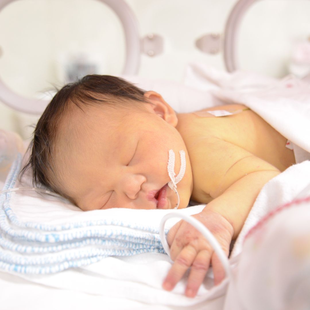 Rapid Emergency Response in ICU