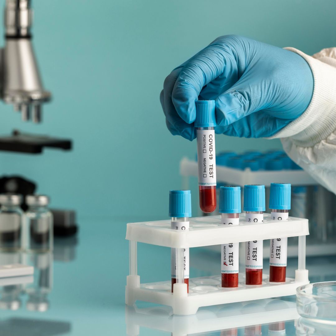 Blood Sample Collection Services